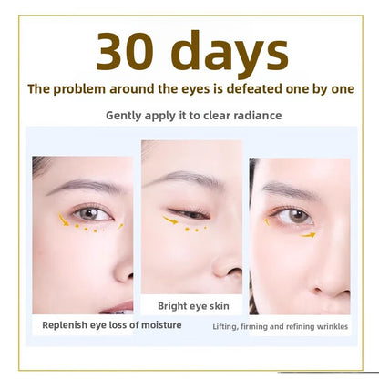 Advertisement for eye cream showing before and after effects on a person's eyes with text about results in 30 days.