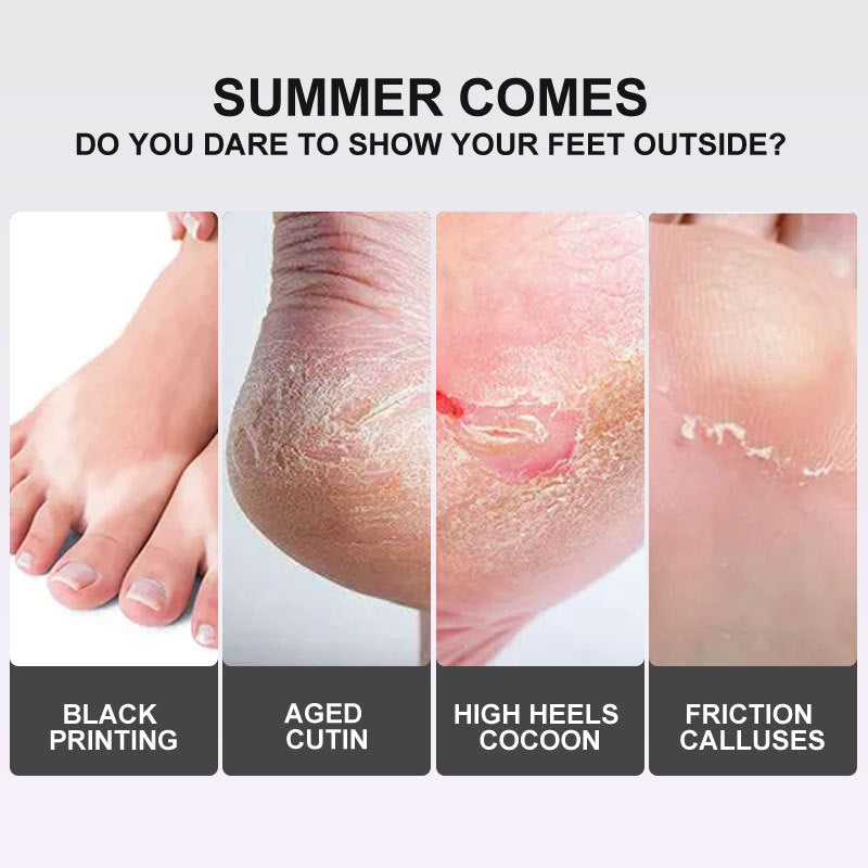 Advertisement showing foot care issues with text about summer and showing feet outdoors.