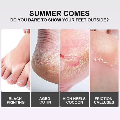 Advertisement showing foot care issues with text about summer and showing feet outdoors.
