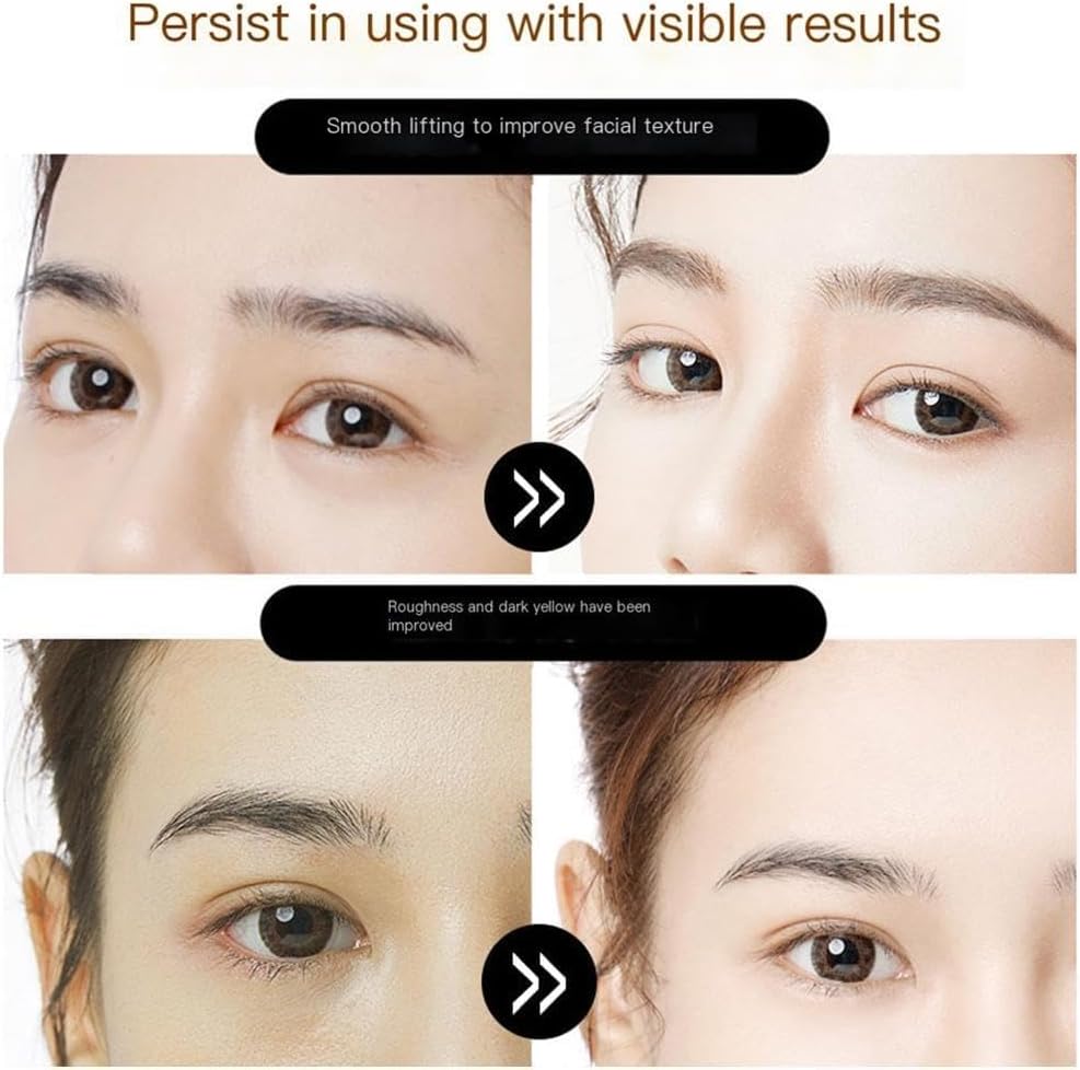 Before and after comparison of facial texture improvement with text 'Persist in using with visible results'.